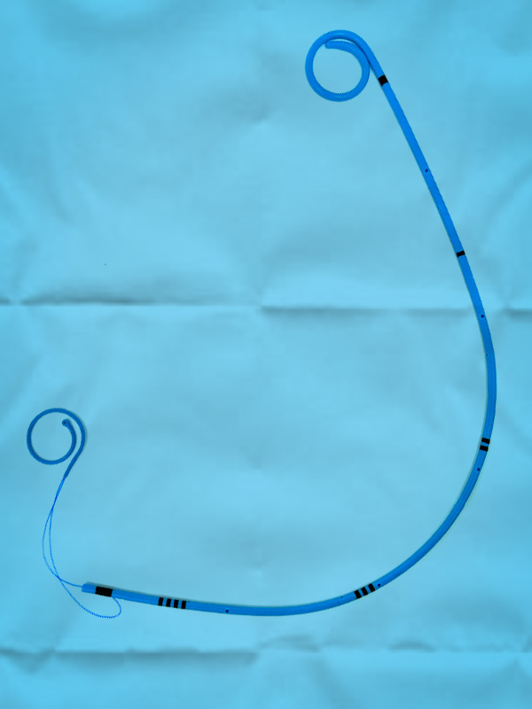 Мочеточниковые стенты: типы, показания и критерии выбора — практический гид для уролога